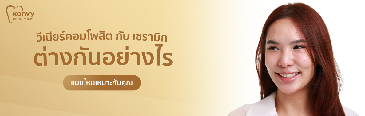 วีเนียร์คอมโพสิต และ เซรามิก