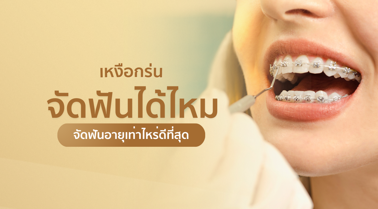 เหงือกร่นจัดฟันได้ไหม อายุเท่าไหร่ดีที่สุด พร้อมวิธีรับมือ