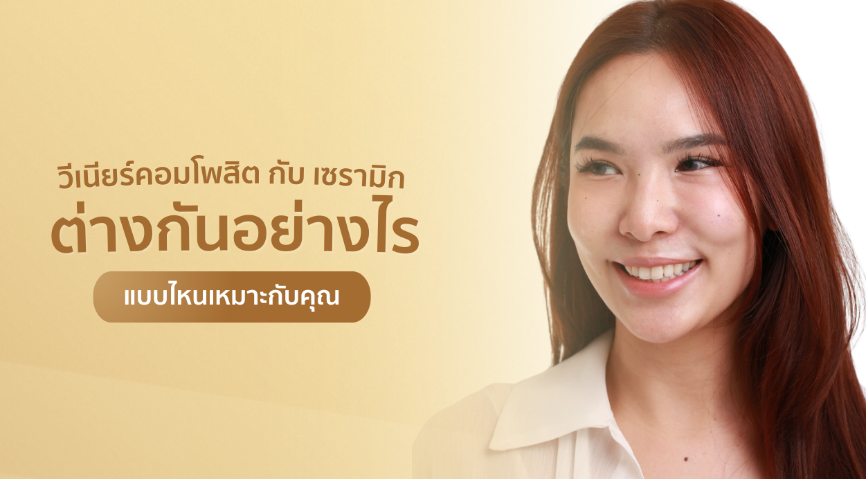วีเนียร์คอมโพสิต และ เซรามิก ต่างกันอย่างไร แบบไหนเหมาะกับคุณ