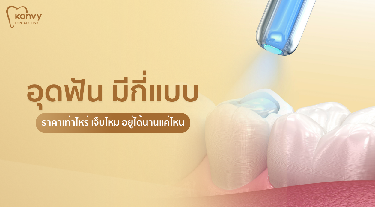 อุดฟันเจ็บไหม? สรุปครบทุกขั้นตอน ราคา และวัสดุอุดฟัน