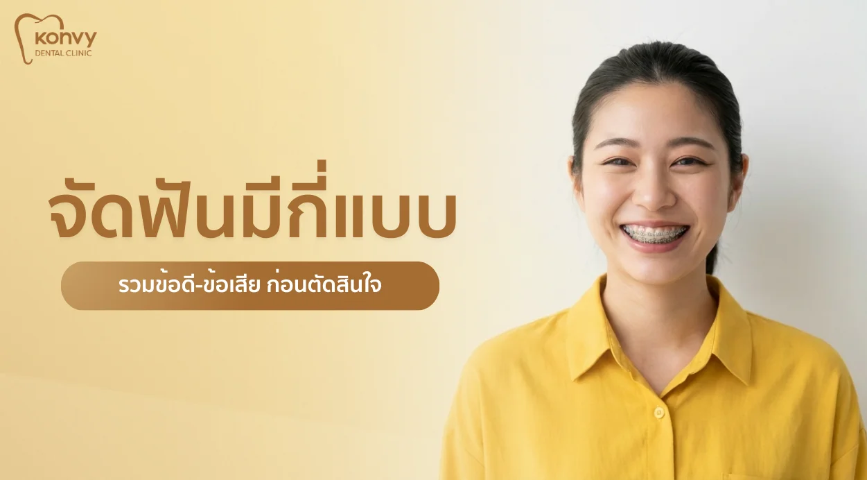 จัดฟันแบบไหนดี? เปรียบเทียบ 4 รูปแบบยอดฮิต พร้อมวิธีเลือกให้คุ้ม