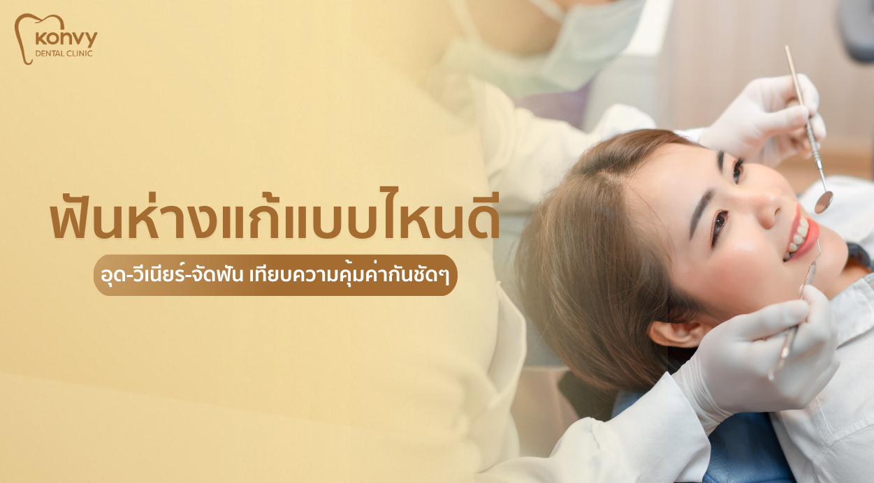 ฟันห่างแก้แบบไหนดี
